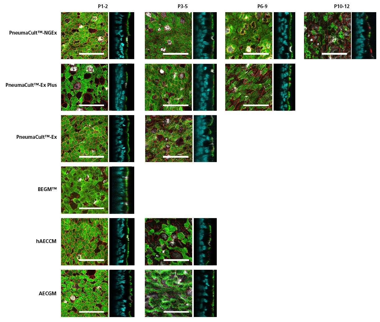 HBECs Expanded in PneumaCult™-NGEx Form Pseudostratified Epithelium with Expansive Cilia and Secretory Cell Expression After Differentiation with PneumaCult™-ALI.