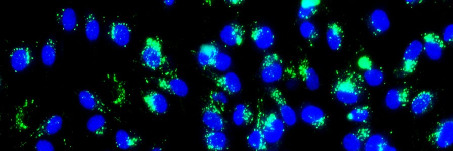 Endothelial Colony-Forming Cells