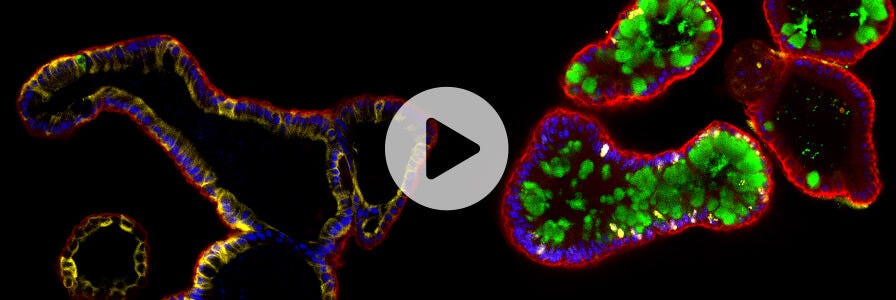 Title of the webinar along with intestinal organoid images