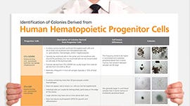 Explore the path a hematopoietic stem cell takes to maturity with our quick reference guide to human hematopoietic progenitors.