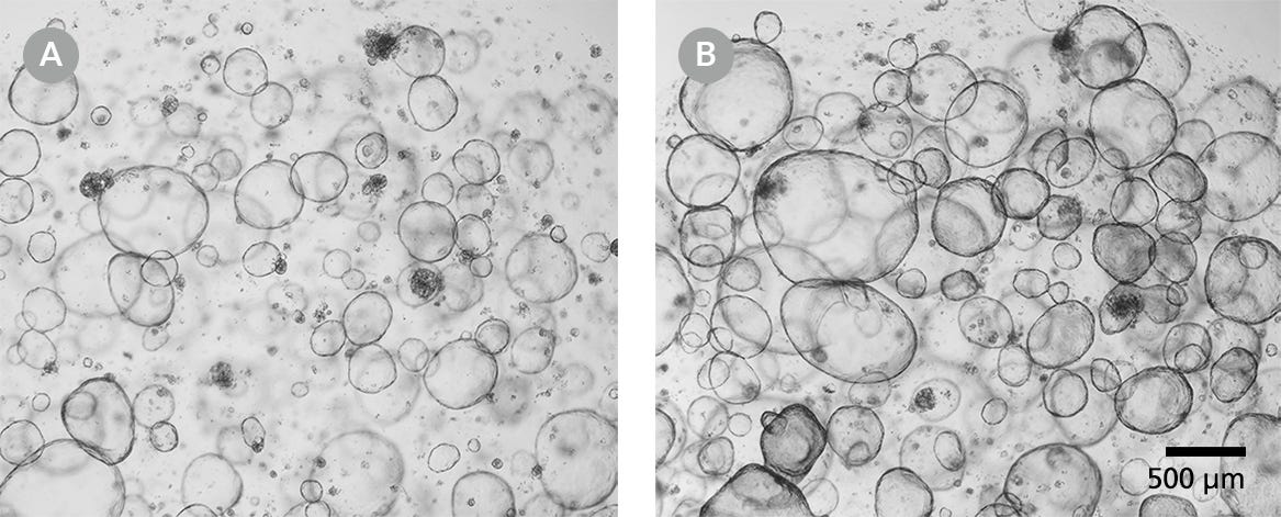 Human Intestinal Organoids