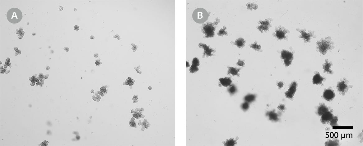 Mouse Intestinal Organoids