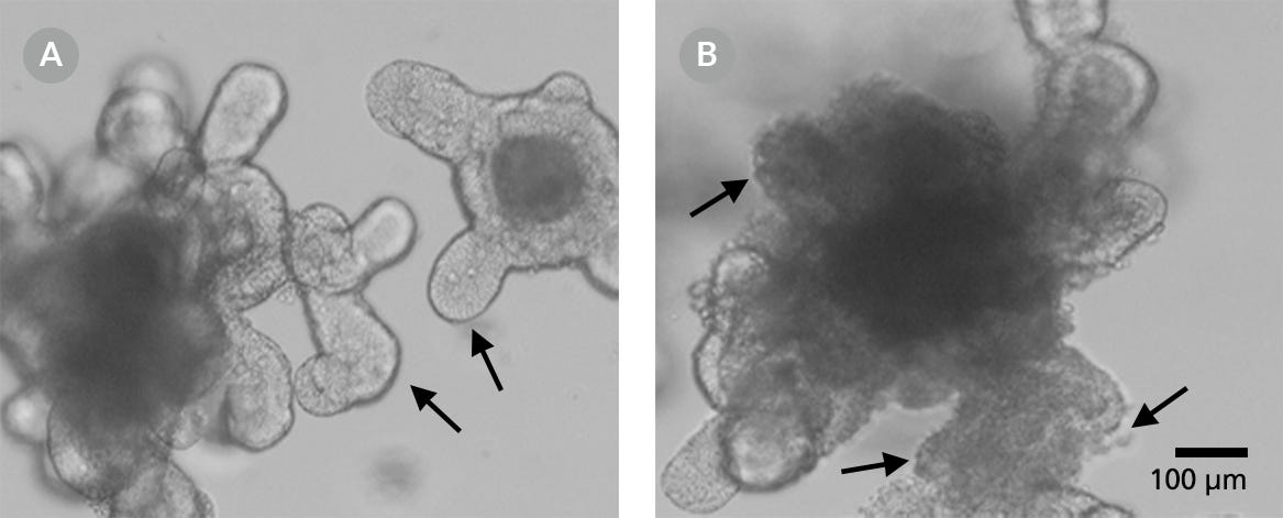 A Smooth Surface is Indicative of a Healthy Organoid, whereas Blebbing Indicates Deterioration in Organoid Quality