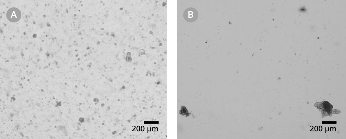 Light Microscope Visualizations of Intestinal Organoid Cultures from Frozen Organoids