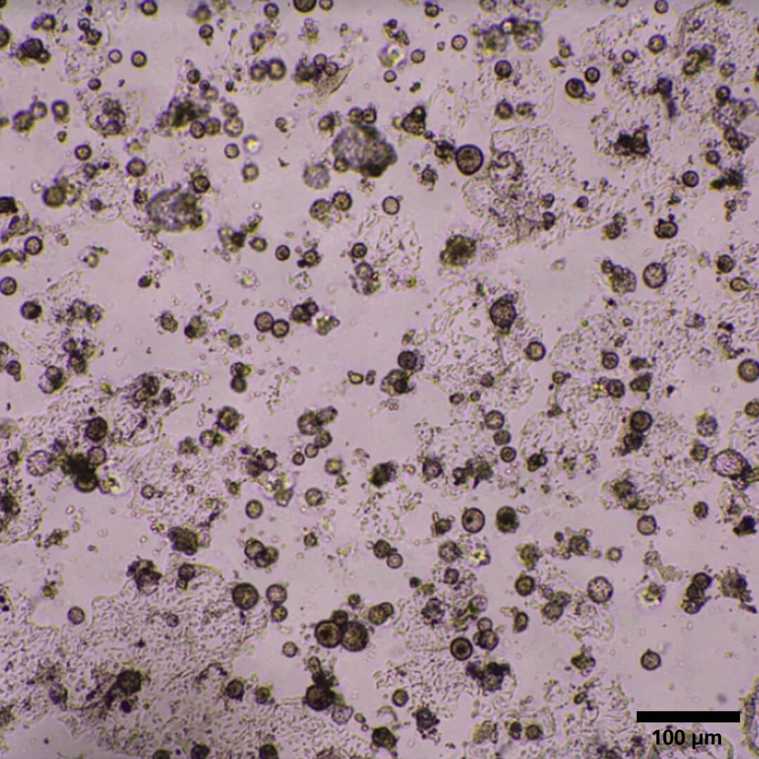 Brightfield Image of Differentiated Alveolar Organoids on Day 19.