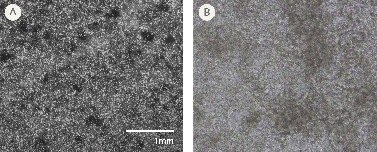 Microscope image and video showing hPSC-derived cardiomyocyte morphology and beating behaviour