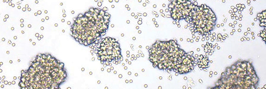 Isolated T cells in culture