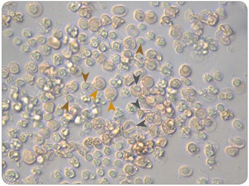 Morphology of Normoblasts, Reticulocytes and Pyrenocytes in Maturation Cultures of Erythroid Progenitor Cells Cultured in SFEM II