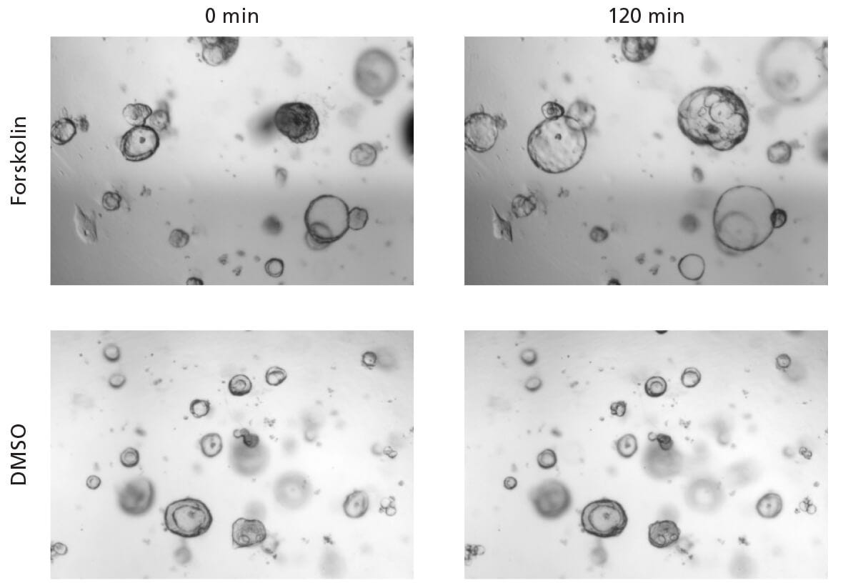 Brightfield microscopy image of intestinal organoids treated with forskolin or with DMSO.