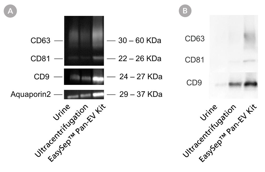 EasySep™ Achieves Higher EV Recovery and Purity from Urine Samples Compared to the Differential Ultracentrifugation Method