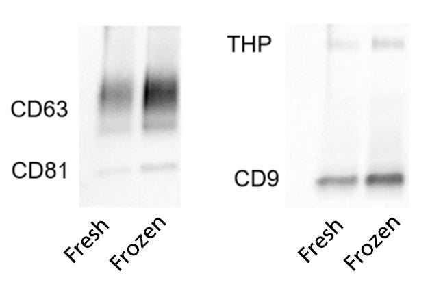 EasySep™ Can Be Used to Isolate EVs from Both Fresh and Frozen Urine