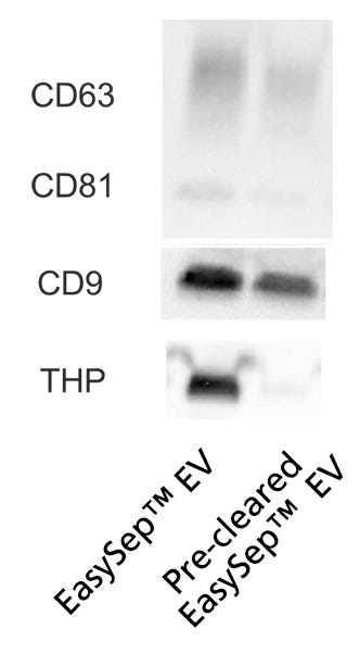 Pre-Clearing Urine Samples Increases EV Purity While Lowering THP Contaminatione