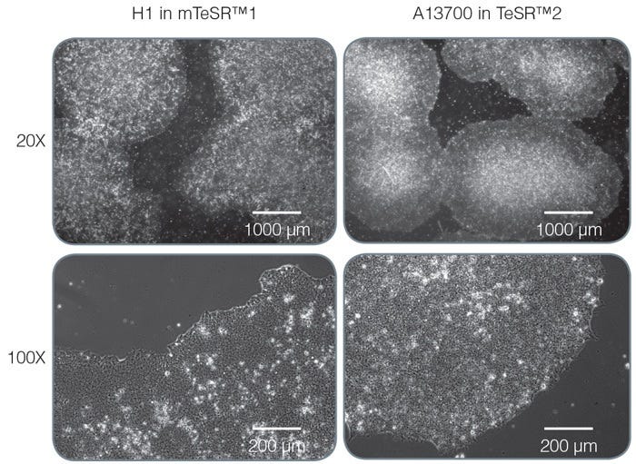 Morphology of colonies passaged using Gentle Cell Dissociation Reagent