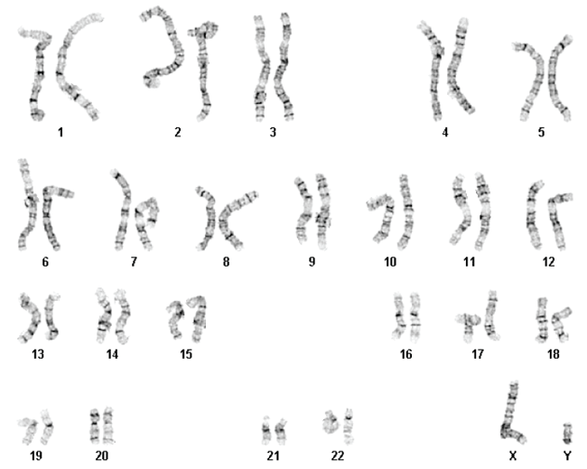 Human ES cells retain normal karyotype after longterm passaging using Gentle Cell Dissociation Reagent