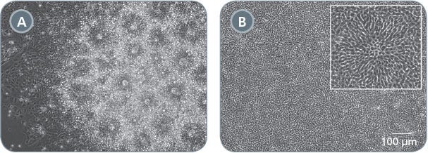 Morphology of Neural Progenitor Cell Cultures Generated Using Embryoid Body and Monolayer Culture Protocols