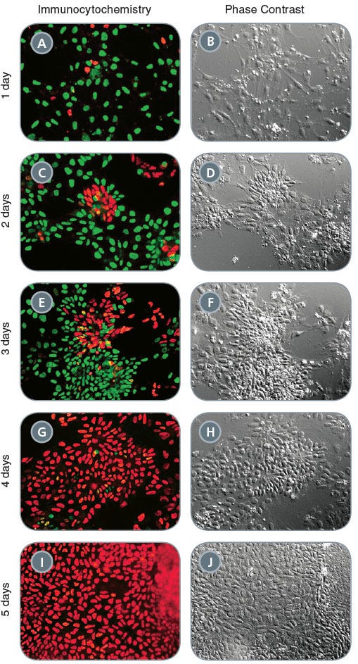 Immunocytochemistry and Phase Contrast Time-Course of Neural Induction of Human iPS Cells Using a Monolayer Culture Protocol