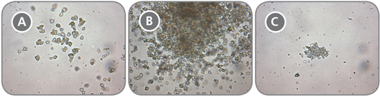 Examples of colonies cultured from rat BM in MethoCult™ M3436.