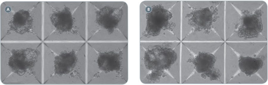 EBs in AggreWell ™400 cardiomyocyte differentiation protocol