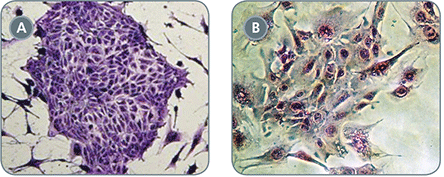 EpiCult™-B (Mouse) Cell Cultures Display Decreased EMT