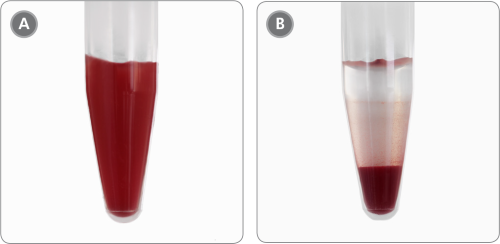 Sample Appearance Before and After Incubation