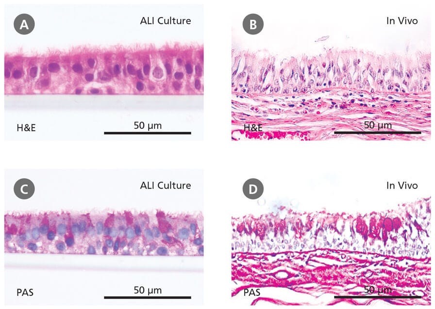 Primary Human Bronchial Epithelial Cells Cultured at the Air-Liquid Interface Recapitulate the In Vivo Bronchial Epithelium