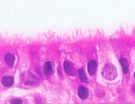 Human Airway Epithelial Cell Training Course