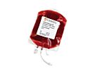 Human Mobilized Peripheral Blood Leukopak, G-CSF, Fresh