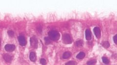 NEW PneumaCult™-ALI Medium for Air-Liquid Interface Culture of Bronchial Epithelial Cells