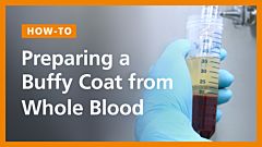 How to Prepare a Buffy Coat from Whole Blood