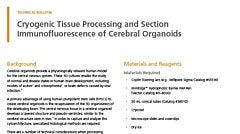 Cryogenic Tissue Processing and Section Immunofluorescence of Cerebral Organoids