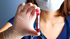 Reagents Distributed Globally for COVID-19 Studies