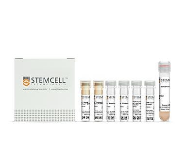 EasySep™ Mouse CD4+CD25+ Regulatory T Cell Isolation Kit II|18783
