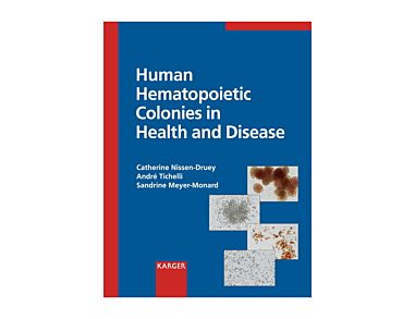 Human Hematopoietic Colonies in Health and Disease