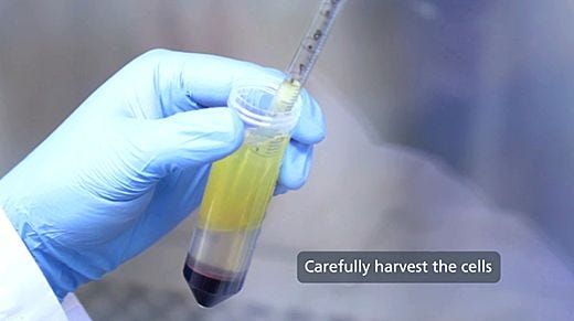 How to Isolate Mononuclear Cells from Whole Blood by Density Gradient Centrifugation