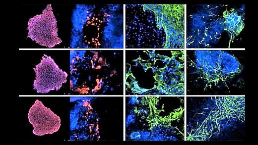 Modeling Genetic Epilepsies with Induced Pluripotent Stem Cells