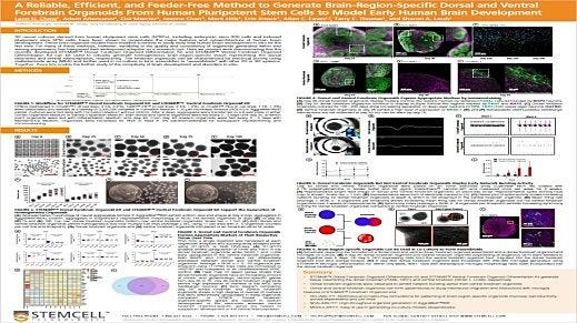 A Reliable, Efficient, and Feeder-Free Method to Generate Brain-Region-Specific Dorsal and Ventral Forebrain Organoids From Human Pluripotent Stem Cells to Model Early Human Brain Development