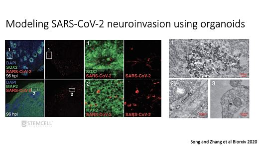 Exploring the Impact of SARS-CoV-2 Infection on the Central Nervous System