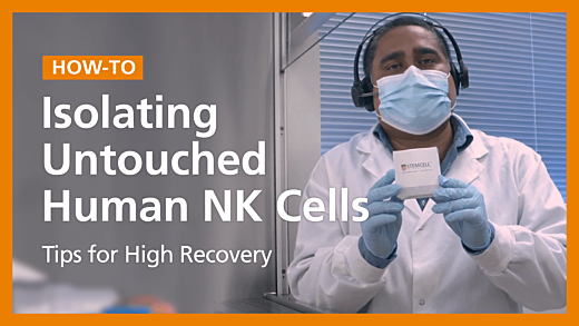 How to Isolate Untouched Human NK Cells and Tips for High Recovery