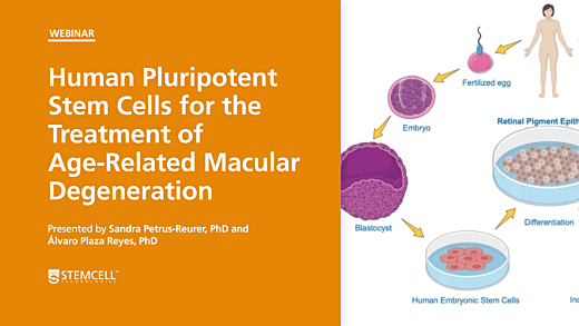 Human Pluripotent Stem Cells for the Treatment of Age-Related Macular Degeneration