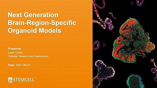 Single-Cell Characterization of Dorsal and Ventral Forebrain Organoid Models