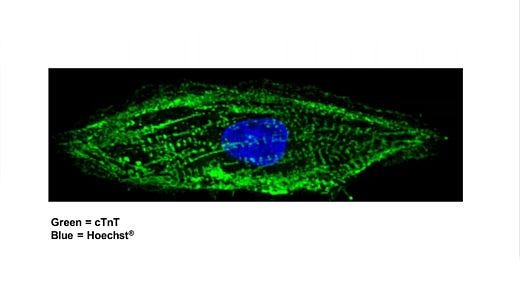 Modeling Arrhythmias Using hPSC-Derived Cardiomyocytes and Tracking Their Excitability