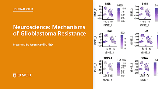 STEMCELL Journal Club: Mechanisms of Glioblastoma Resistance