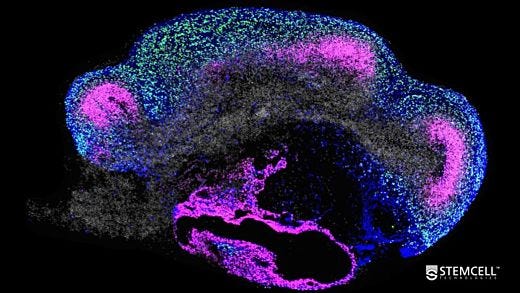 Mini-Symposium: The Evolution and Application of Brain Organoids to Study Human Disease