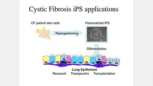 Making Lung Cells from Pluripotent Stem Cells: Disease Modeling and Future Therapies