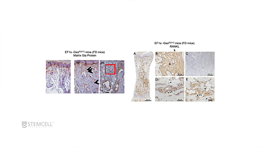 Bone Marrow Skeletal Progenitors and Bone Diseases