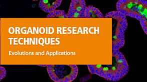 Organoid Research Techniques: Evolution and Applications