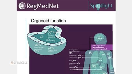 Spotlight on Organoids: Expert Panel