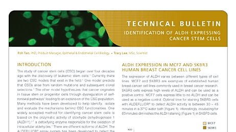 Identification of ALDH-Expressing Cancer Stem Cells Using ALDEFLUOR™