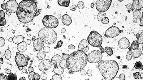Toxicity Testing for Drug Development Using Human Intestinal Organoids and IntestiCult™