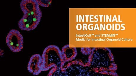 Intestinal Organoids